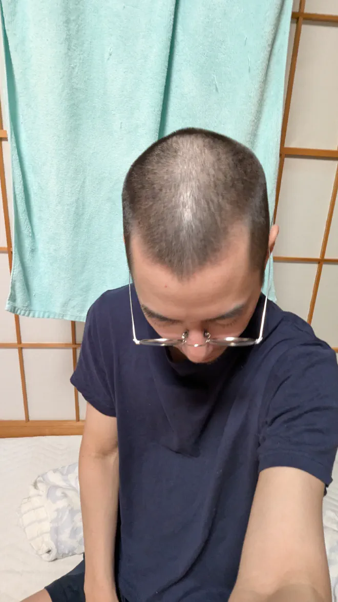 坊主の写真