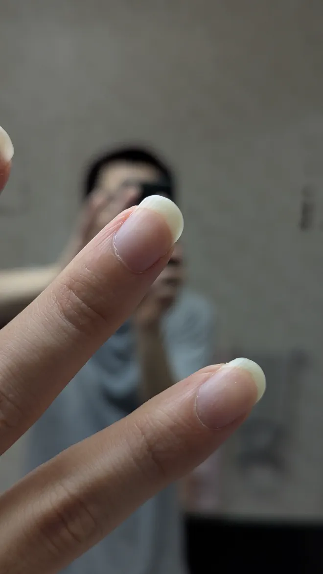 爪の写真